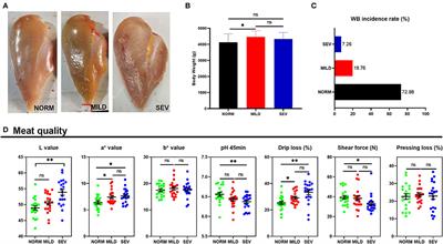 Multi-Omics Analysis of the Microbiome and Metabolome Reveals the Relationship Between the Gut Microbiota and Wooden Breast Myopathy in Broilers